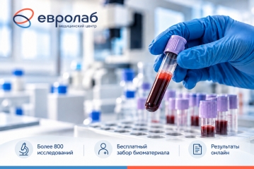 Почему стоит сдавать анализы именно в Евролаб?